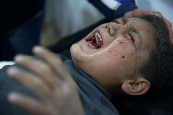 A wounded boy is seen in hospital in the town of Hamoria, eastern Ghouta in Damascus